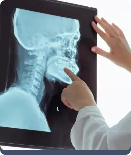 Scanner intraoral itero