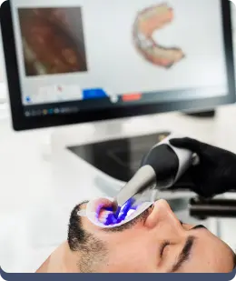 Scanner intraoral itero